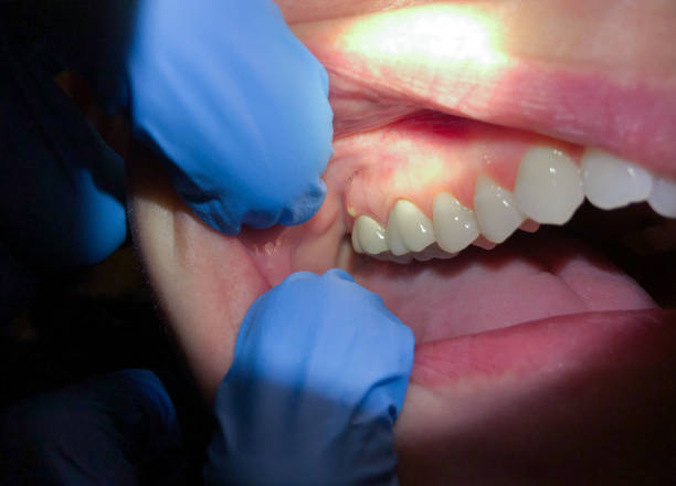 Best Emergency Orthodontic Repairs in Five Forks, SC